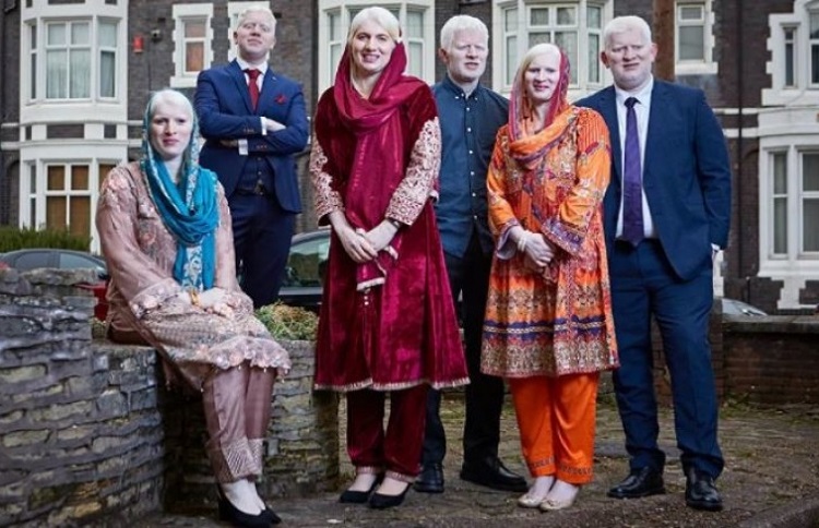 
														
														Dunyodagi eng katta albinoslar oilasi “Ginness rekordlari” kitobiga kiritildi
														
														