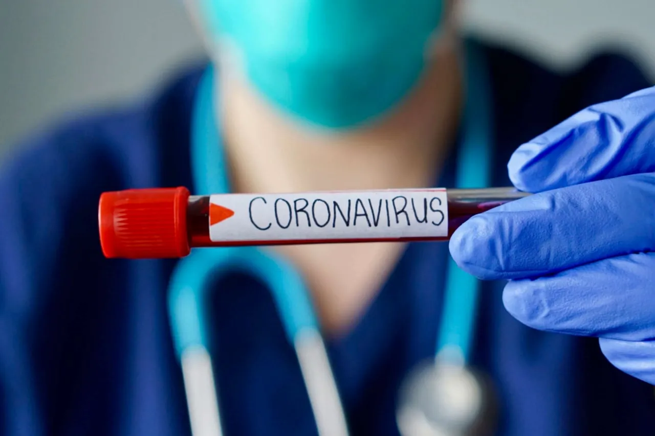 
											
											Kecha yana 162 nafar kishida koronavirus aniqlandi
											
											