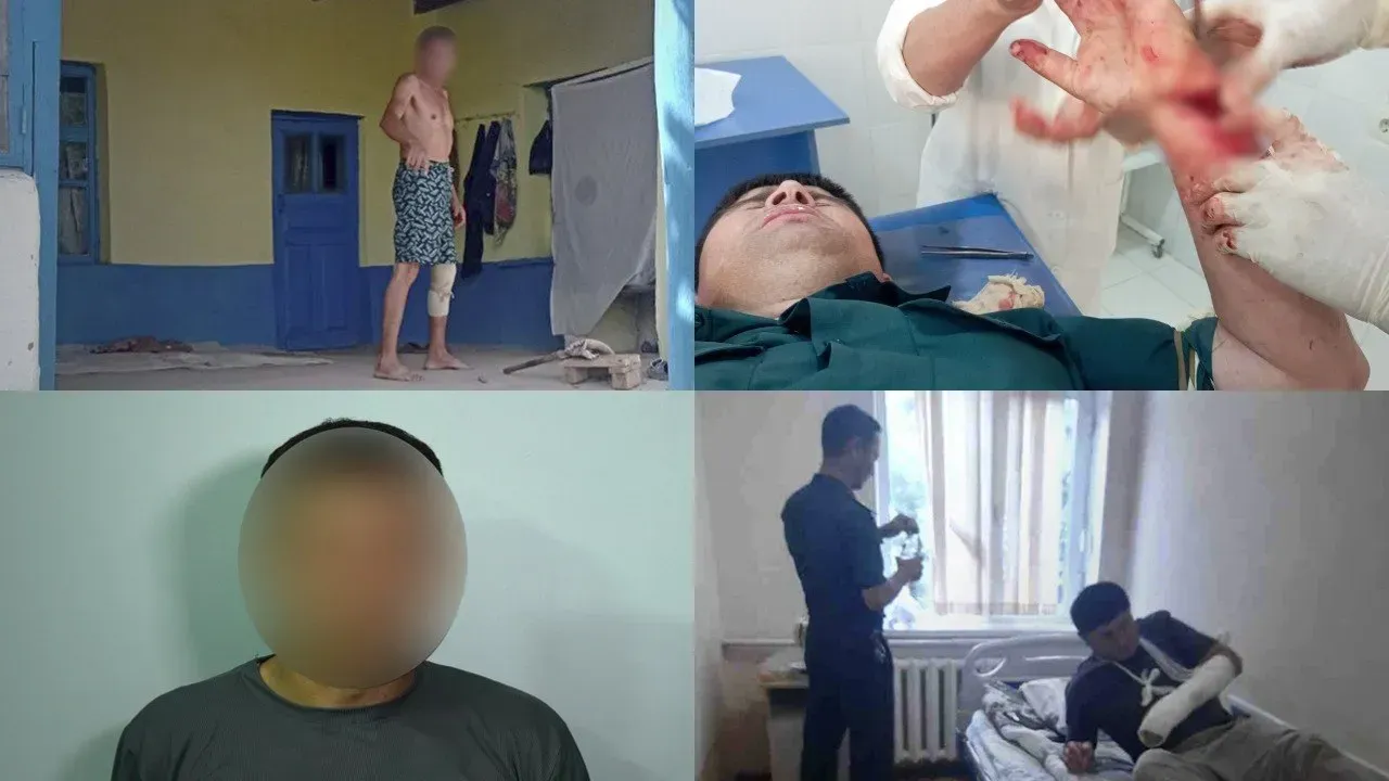 
											
											Сурхондарёда фуқаро профилактика инспекторига болта билан ҳужум қилди
											
											