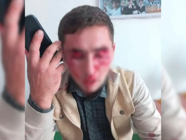 
														
														Ўқитувчи маст эркак томонидан калтакланди
														
														