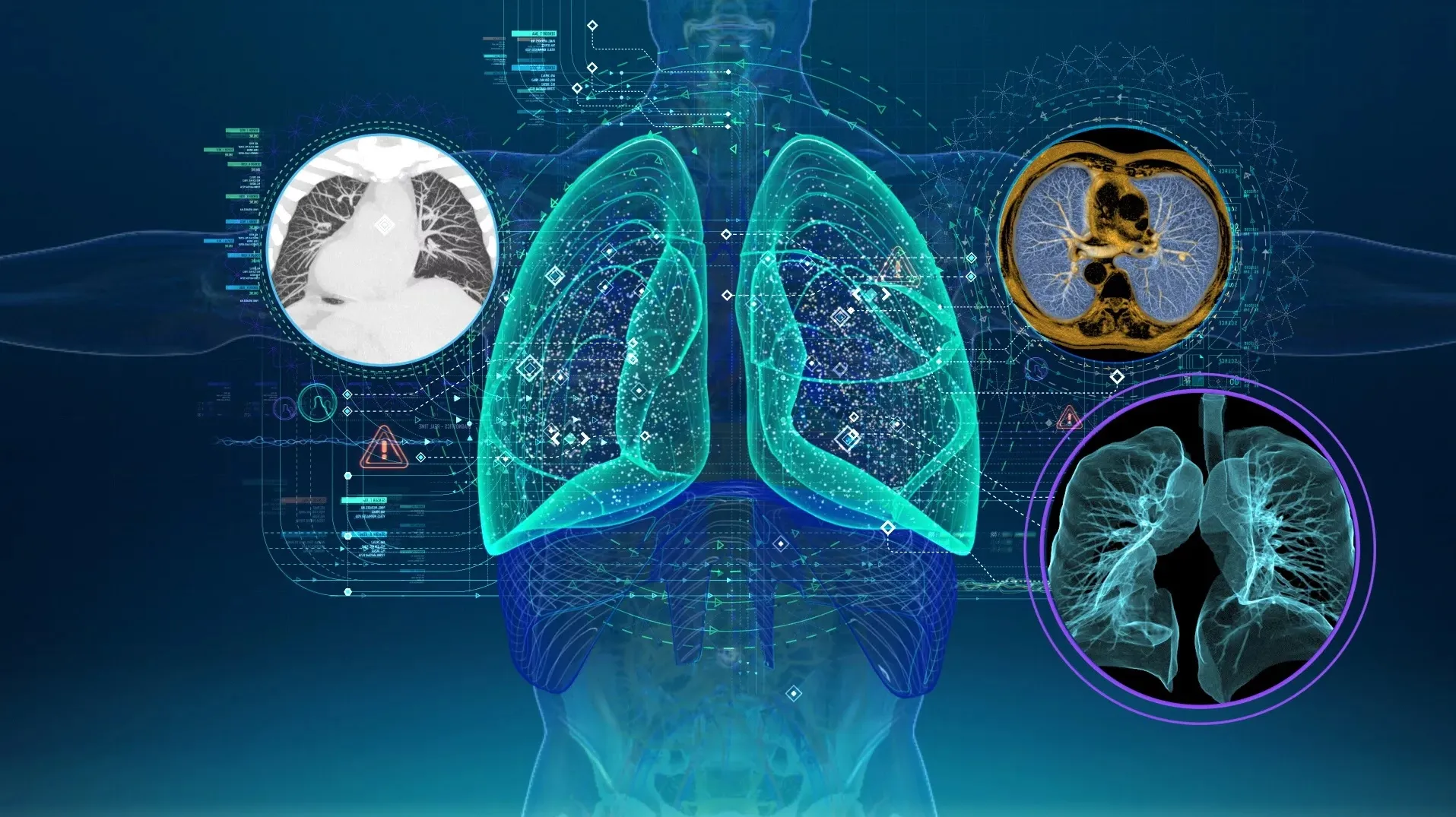 Ўзбекистонда сил ва ўпка касалликларини сунъий интеллект орқали ташхислаш йўлга қўйилди – ССВ