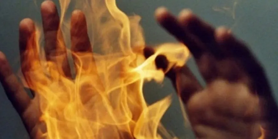 Ayol qizining homiladorligini ko‘tara olmay, o‘zini yoqib yubordi