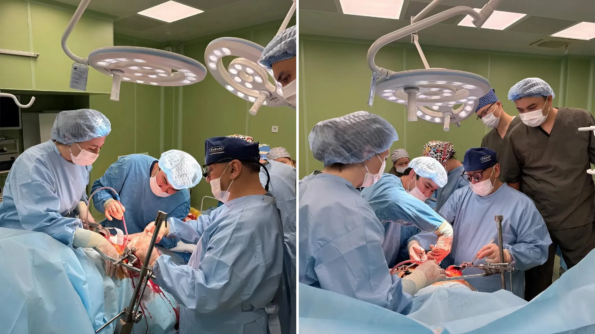 Қозоғистонда донор аёл 6 кишининг ҳаётини сақлаб қолди