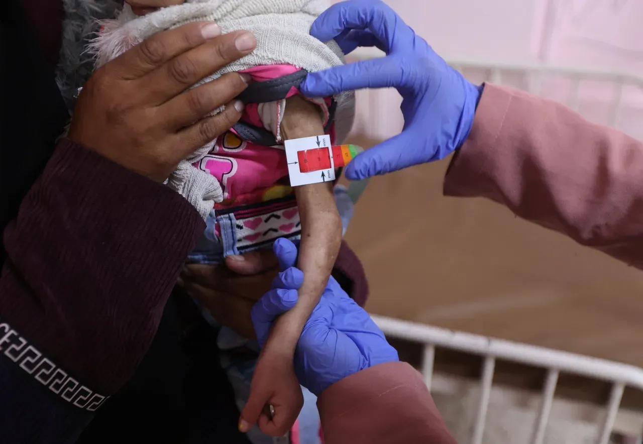 
														
														G‘azoda qariyb 95 000 bola to‘yib ovqatlanmaslik muammosiga duch kelmoqda – BMT
														
														