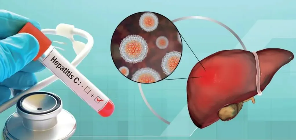 Миср гепатит “С” га қарши дори воситасини Ўзбекистонда ишлаб чиқаришни режалаштирмоқда